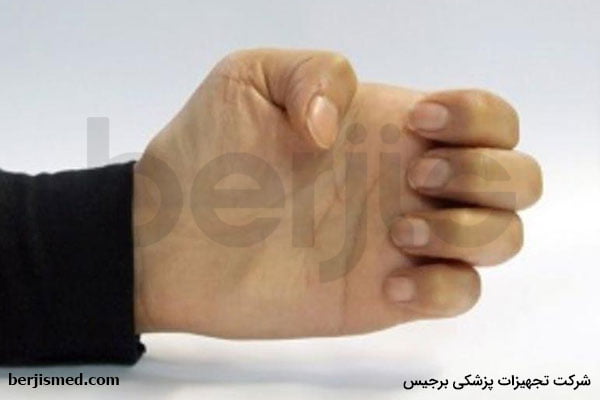 نرمش کشش چنگالی انگشتان دست