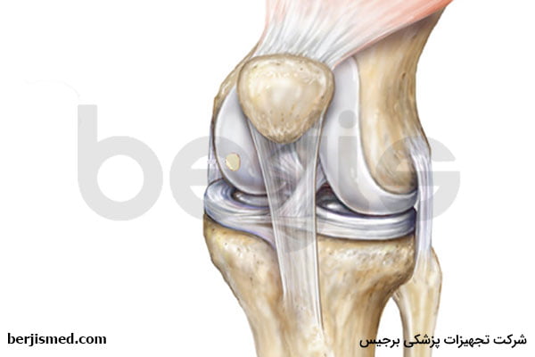 علل بروز نرمی غضروف کشکک زانو