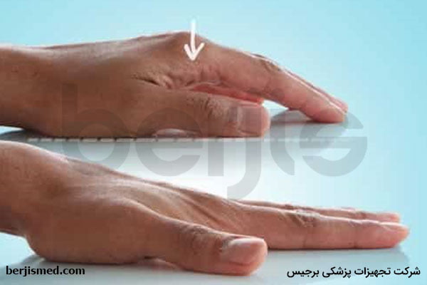 کشش سطح دست