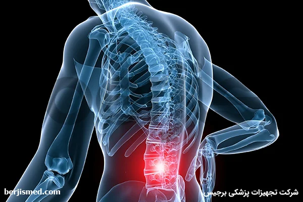 کمر درد و عوامل مؤثر بر آن