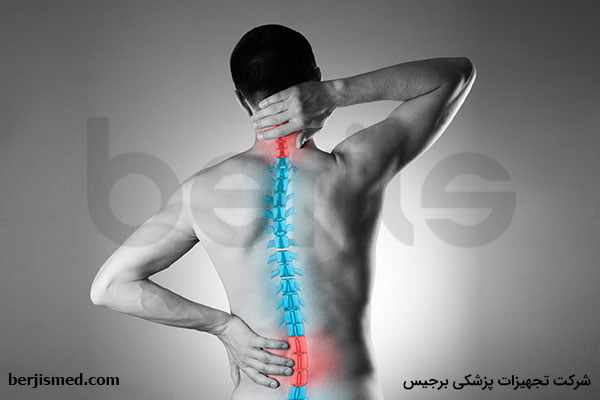 انواع ورزش های اسکولیوز