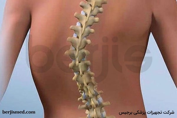 روشهای درمانی انواع اسکولیوز