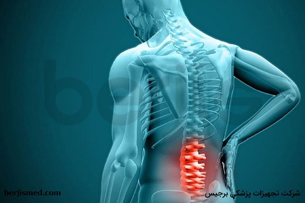 روش‌های درمان بیماری مفصل ستون فقرات یا بیماری فاست