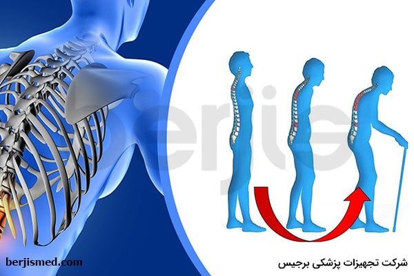 عوامل خطرساز ابتلا به پوکی استخوان ناشی از گلوکوکورتیکوئید کدامند؟