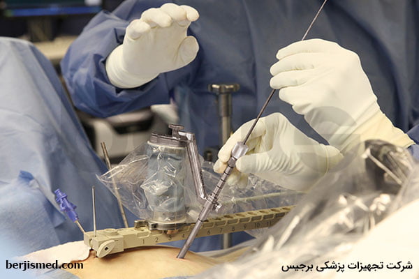 تفاوت‌های بارز عمل جراحی دیسک کمر با لیزر و سایر روش‌ها