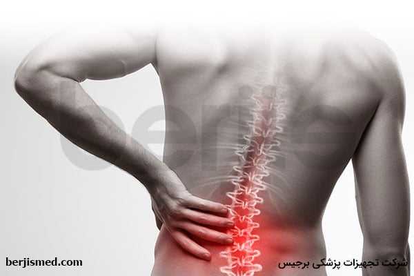 انواع شکستگی مهره های کمر