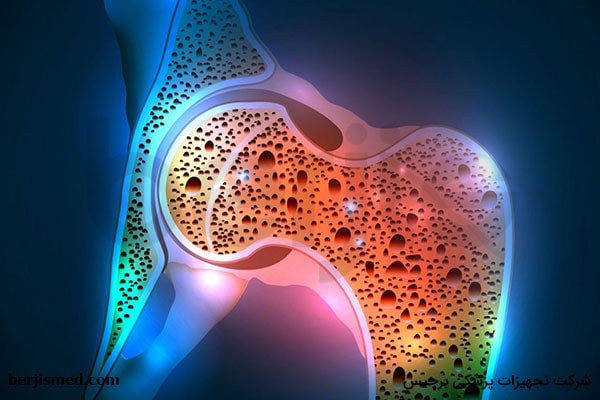 چگونه از پوکی استخوان جلوگیری کنیم؟
