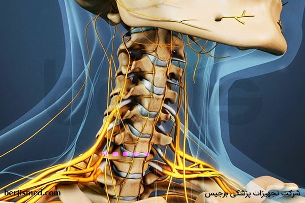 هر آنچه که باید درباره تنگی کانال نخاعی گردن بدانید
