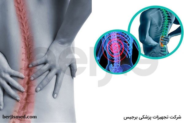 علل دیسک کمر و تغییرات تنه مهره پس از دیسک کمر