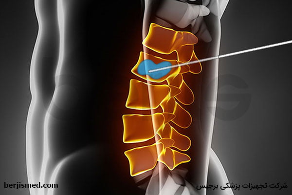 ورتبروپلاستی و کایفوپلاستی