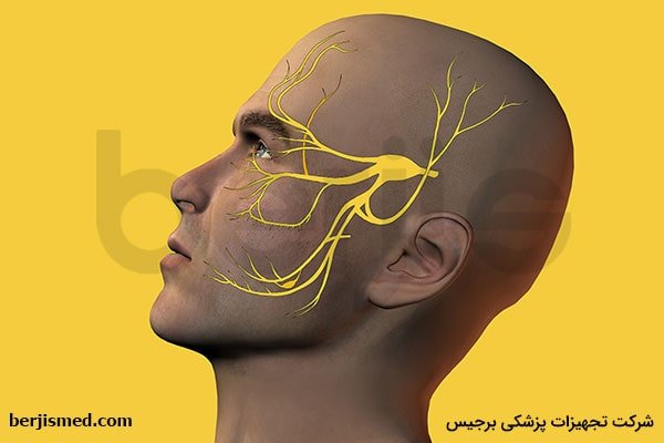 درمان نورالژی عصب سه قلو صورت