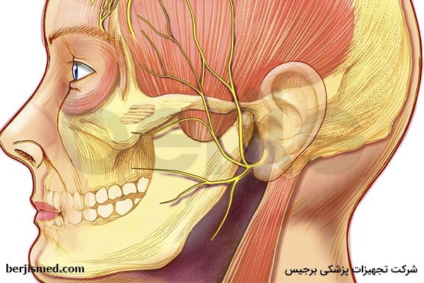درمان نورالژی عصب سه قلو صورت