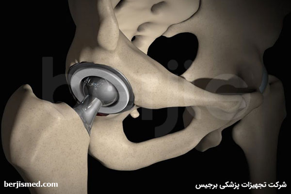 عمل تعویض مفصل لگن