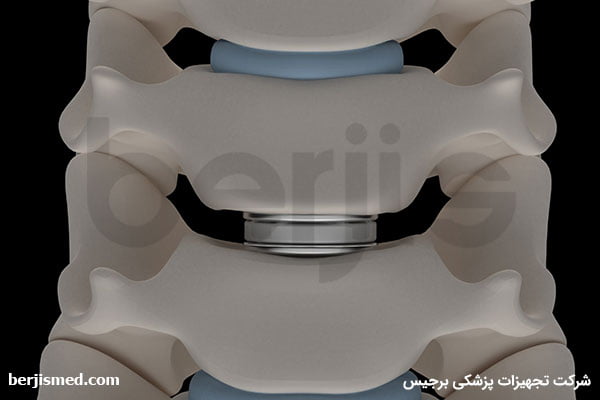 تغذیه و جریان خون دیسک بین مهره ای