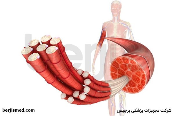 بیماری میوپاتی چیست؟