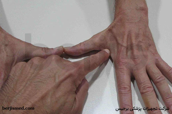 درمان بیماری میوپاتی