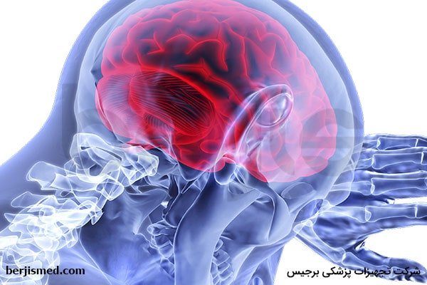 نشانه‌های سکته مغزی