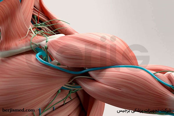 هر آنچه که باید درباره سندرم خروجی قفسه سینه بدانید