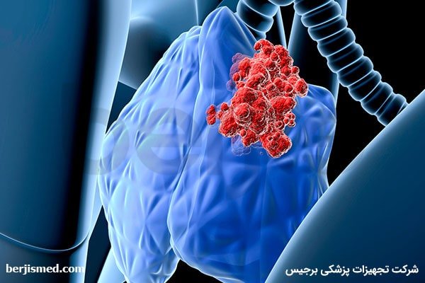 انواع تومور