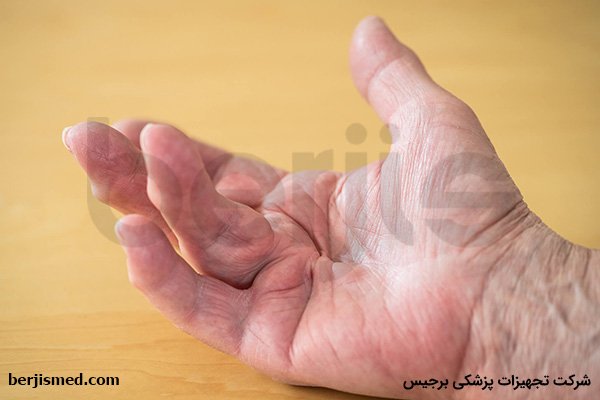 علائم و نشانه های بیماری دوپوئیترن (Dupuytren)