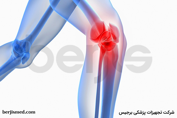 علائم اب اوردن زانو و راه های درمان افیوژن