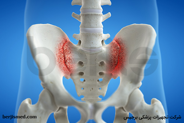 آشنایی با مفصل ساکروایلیاک