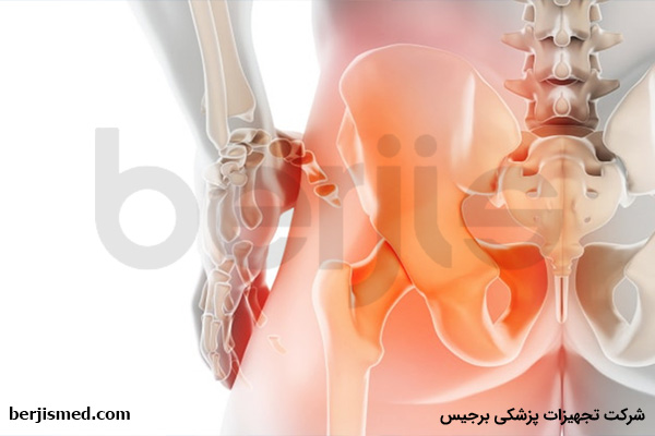 درمان درد مفصل ساکروایلیاک