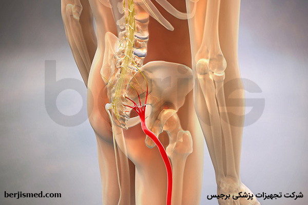 درمان درد عصب سیاتیک با فیزیوتراپی کمر
