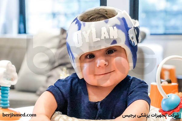 علائم تورتیکولی یا کجی گردن