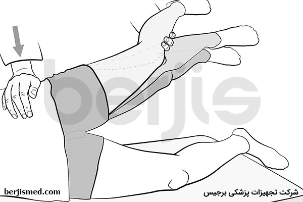 تست فری برگ برای کشف  سندروم پیریفورمیس