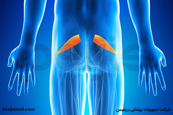 سندروم پیریفورمیس چیست؟