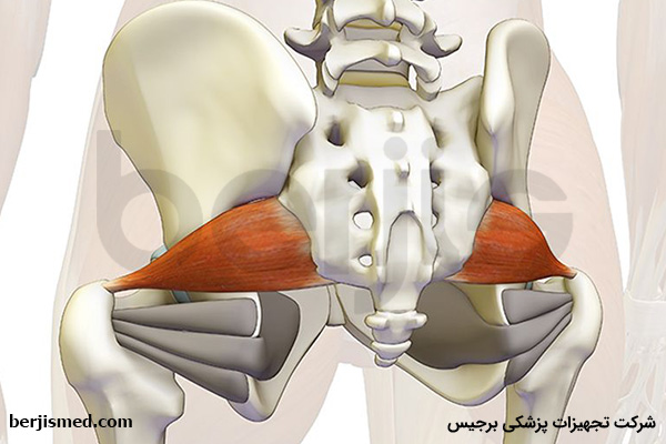 آشنایی با سندروم پیریفورمیس و علائم آن