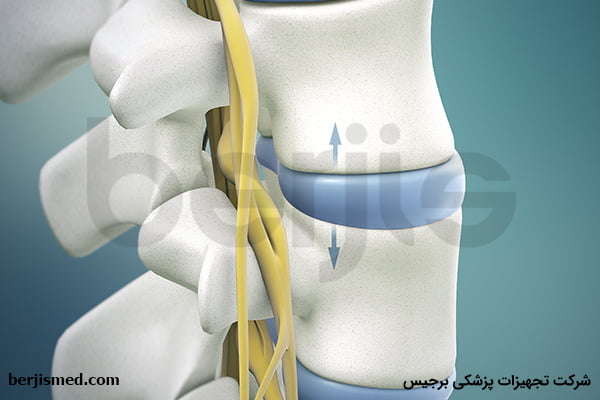 آشنایی با سیستم ستون فقرات و دیسک کمر