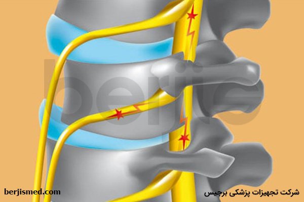 عواقب کم آبی دیسک کمر چیست؟