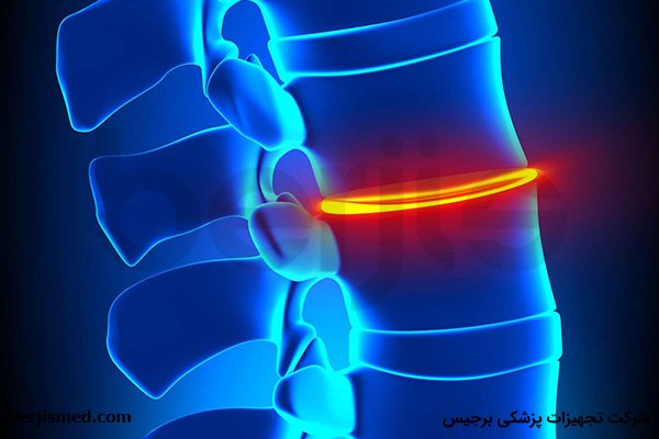 تاثیر کم آبی روی ستون فقرات و کمر