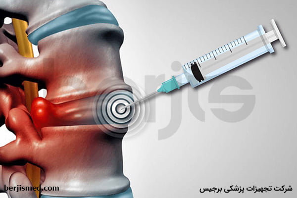 مراحل تزریق اپیدورال
