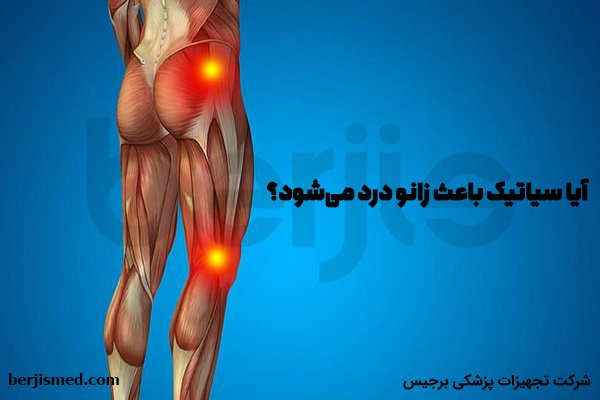 آیا سیاتیک باعث زانو درد می شود؟