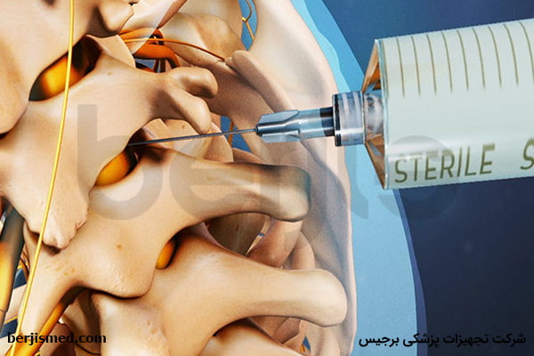 مراقبت های بعد از تزریق اپیدورال
