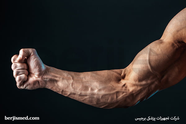 درمان خانگی باد کردن رگ های دست