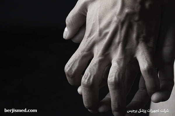 علت باد کردن رگ دست