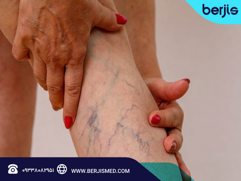 چه کسانی در معرض خطر بیشتری قرار دارند؟