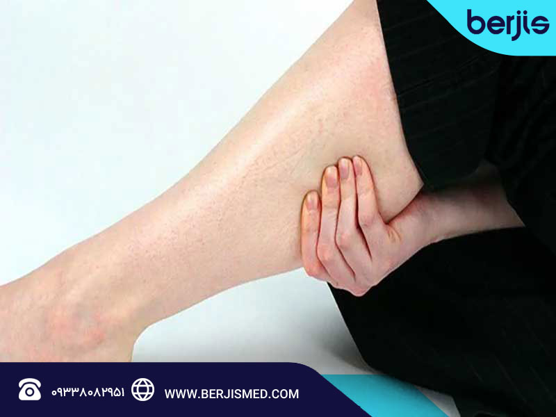 نشانه های لخته شدن خون در پا